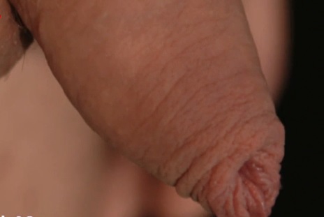 Mutter Naturs bzw. Gottes Werk: unbeschnittiner Penis